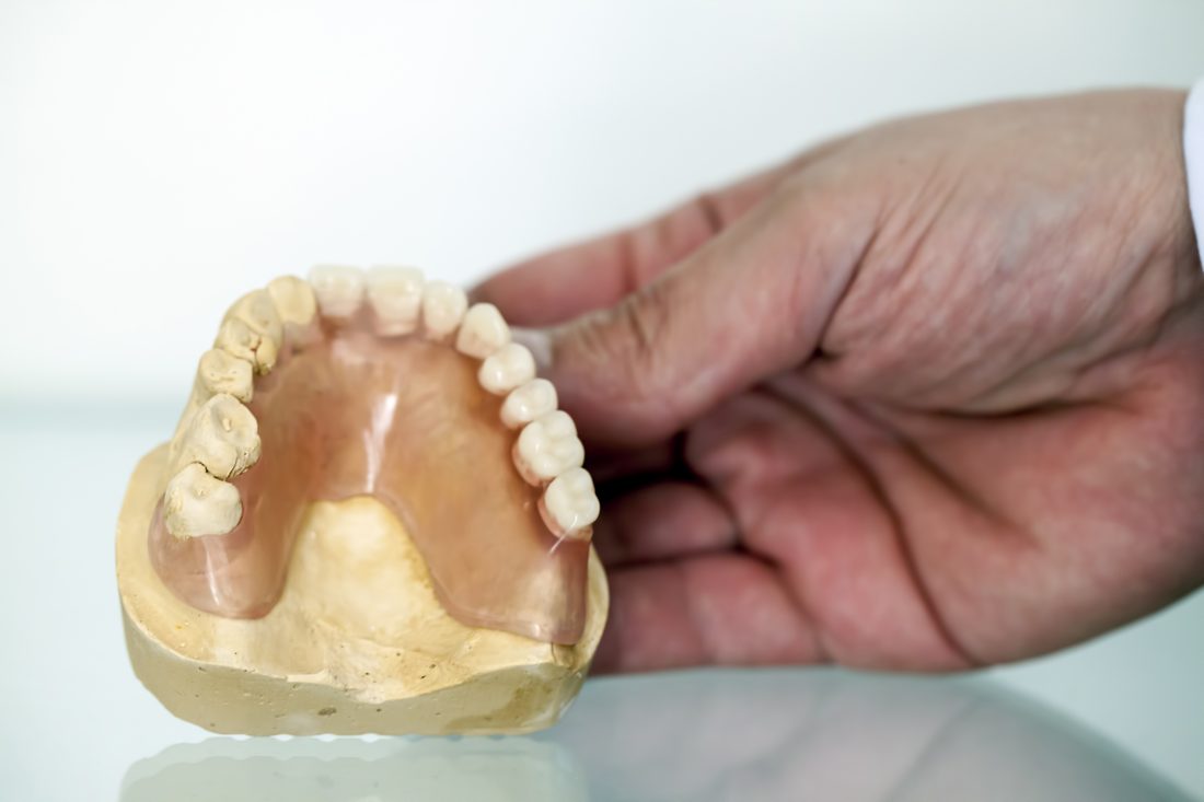 Zirconia and porcelain crown on a working model.